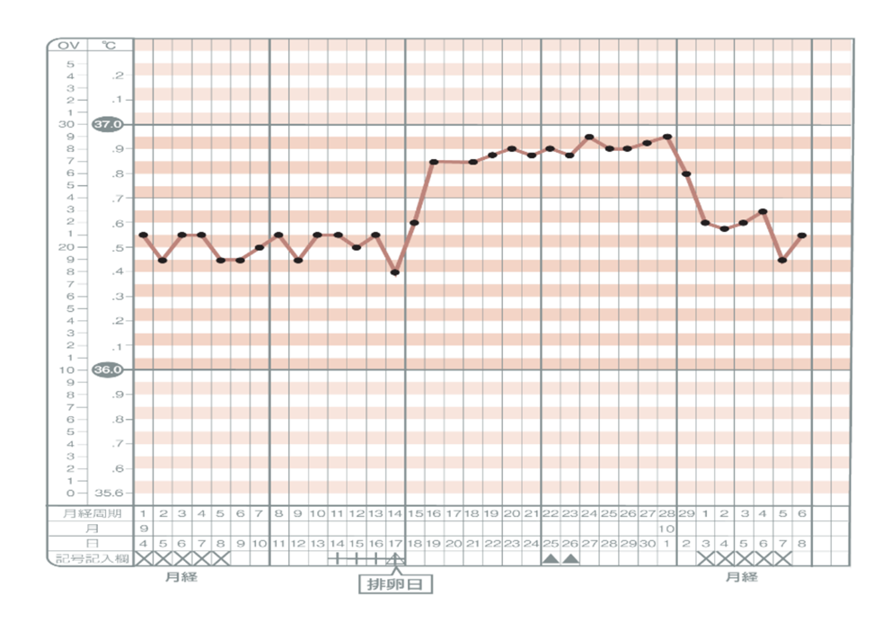 高温期が短いタイプ、高温期がガタガタしているタイプの基礎体温グラフ
