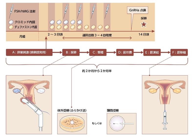 ART(アート)とは、 assisted reproductive technology（日本語で生殖補助医療技術）の略語です。体外受精、顕微授精を含みます。