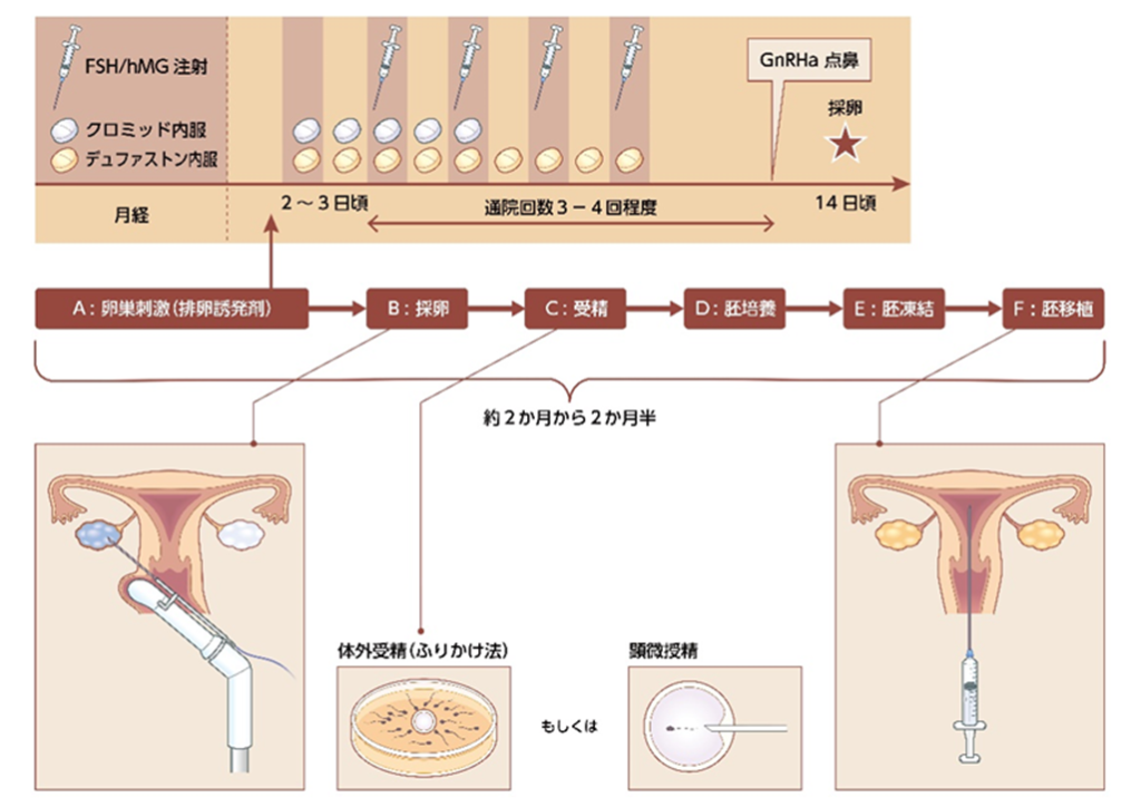 不妊治療と仕事は両立できる?難しいと言われる理由や現状について解説 | 松本レディースIVFクリニック-池袋のJISART認定 体外受精/不妊治療